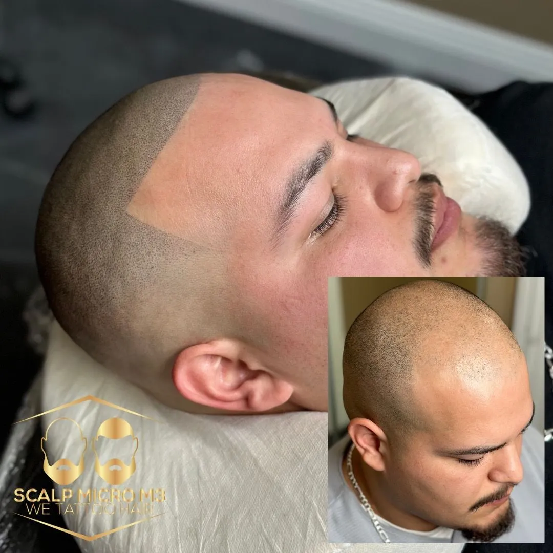 before-and-after