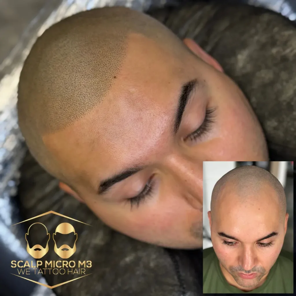 before-and-after