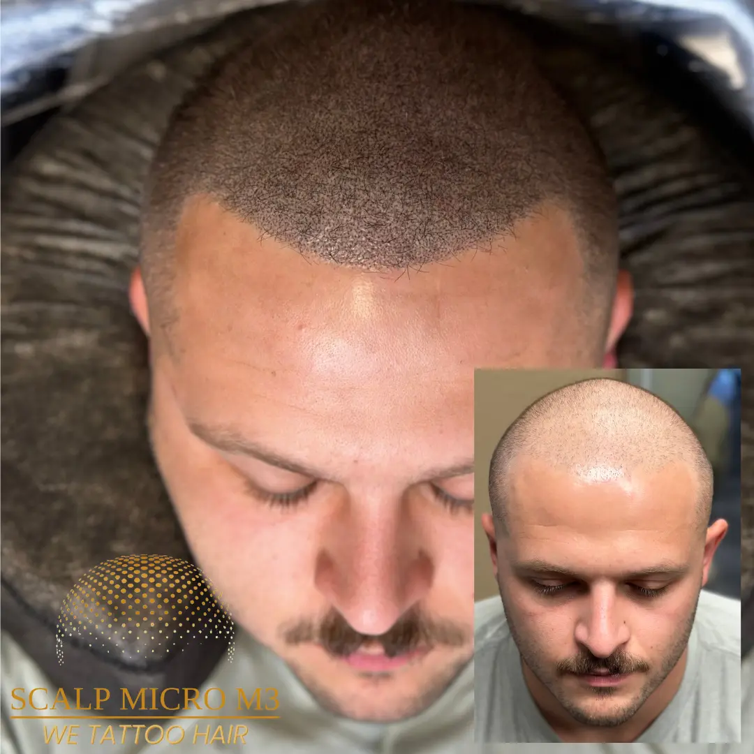 before-and-after